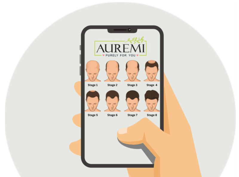 First Big Left IOmage Replaced